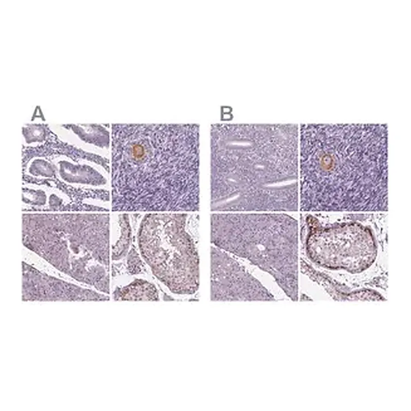 Merck Anti-IGF2BP1 antibody produced in rabbit