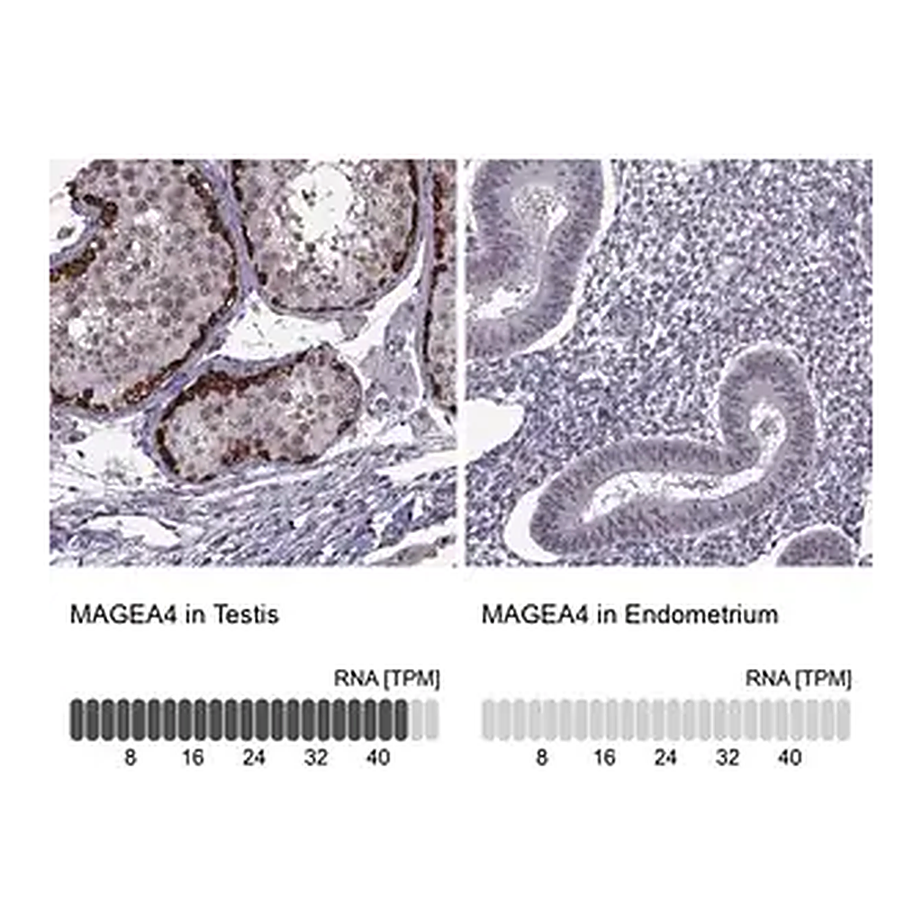 Merck Anti-MAGEA4 antibody produced in rabbit