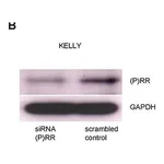Merck Anti-ATP6AP2 antibody produced in rabbit