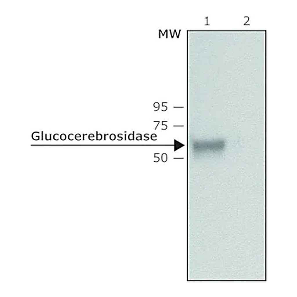 Merck Anti-Glucocerebrosidase antibody produced in rabbit