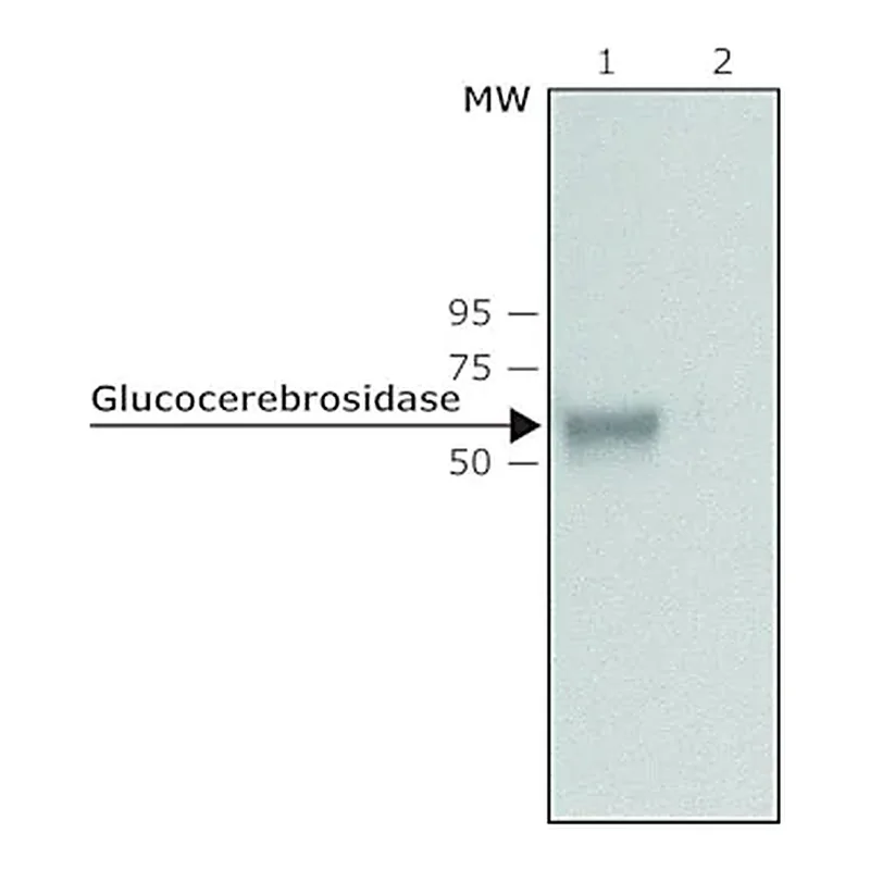 Merck Anti-Glucocerebrosidase antibody produced in rabbit