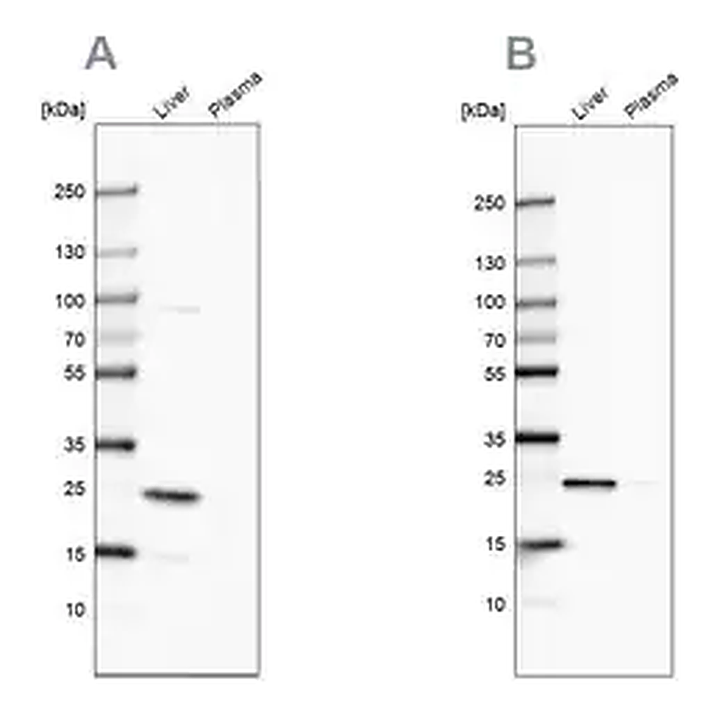 Merck Anti-CRP antibody produced in rabbit