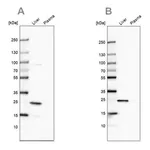 Merck Anti-CRP antibody produced in rabbit