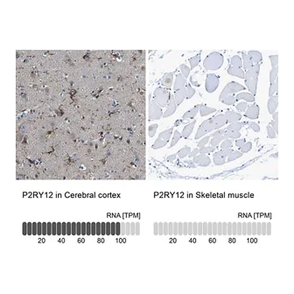 Merck Anti-P2RY12 antibody produced in rabbit