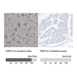 Merck Anti-P2RY12 antibody produced in rabbit