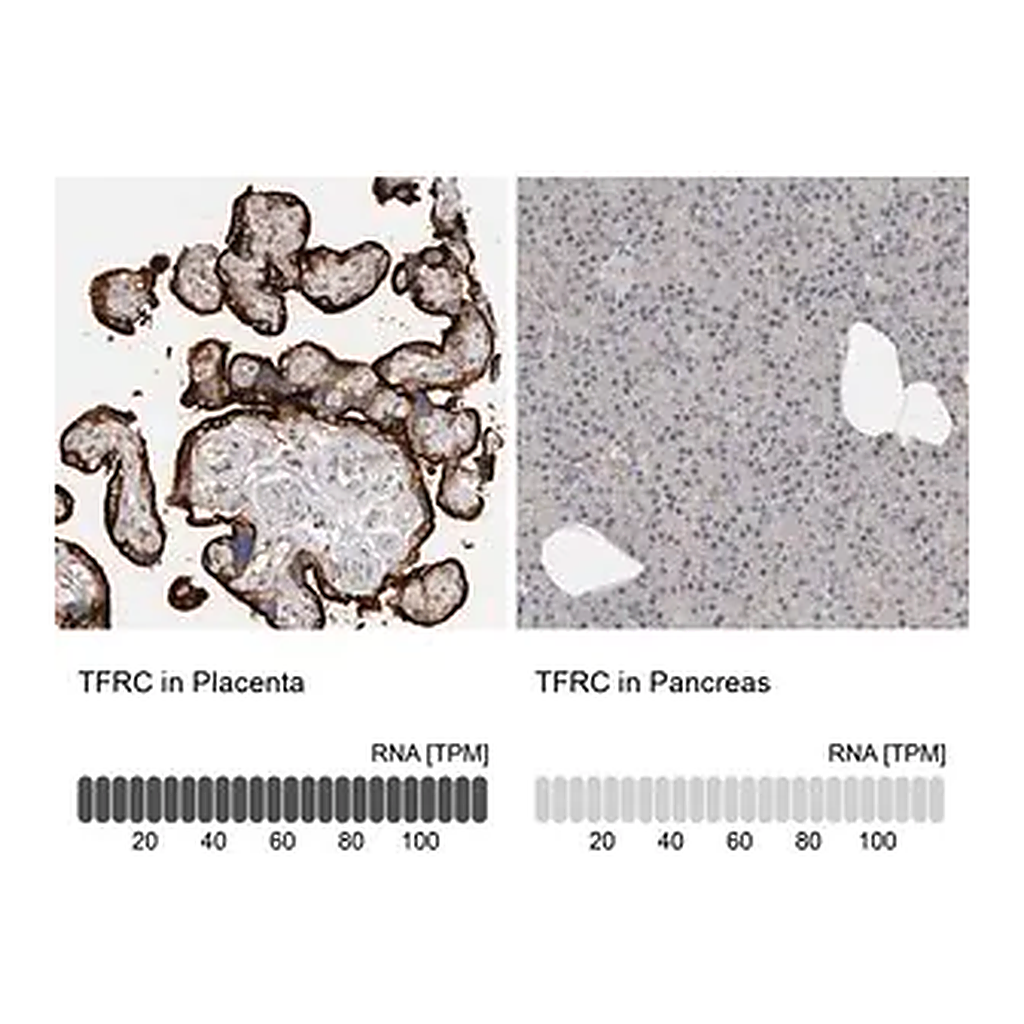 Merck Anti-TFRC antibody produced in rabbit