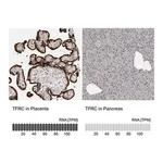 Merck Anti-TFRC antibody produced in rabbit