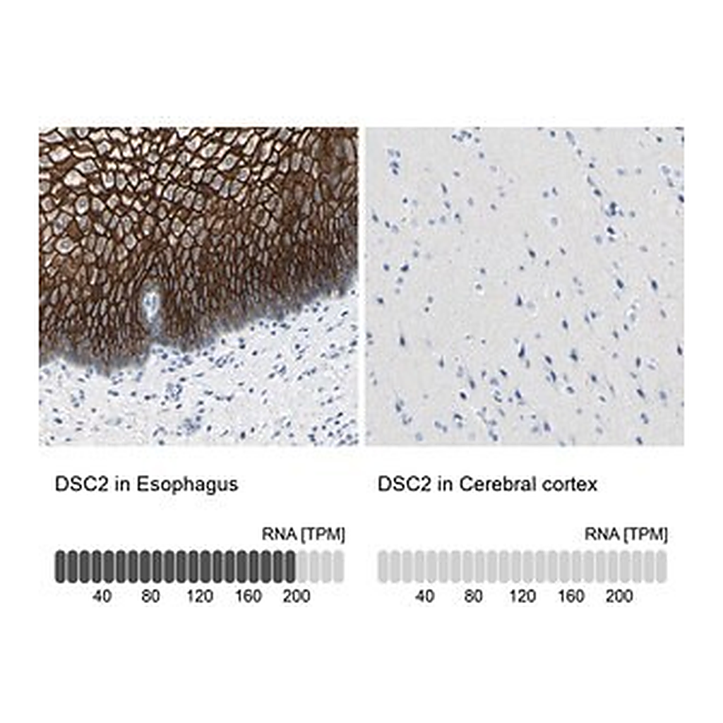 Merck Anti-DSC2 antibody produced in rabbit