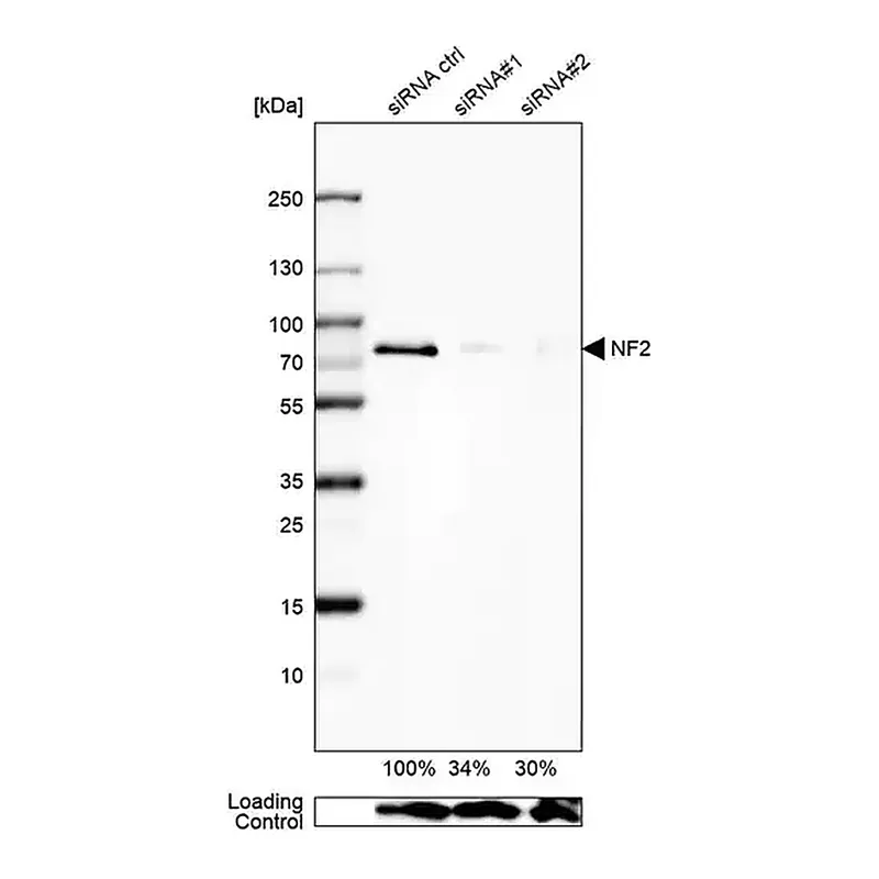 Merck Anti-NF2 antibody produced in rabbit