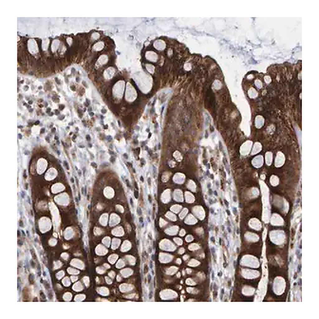 Merck Anti-LRBA antibody produced in rabbit