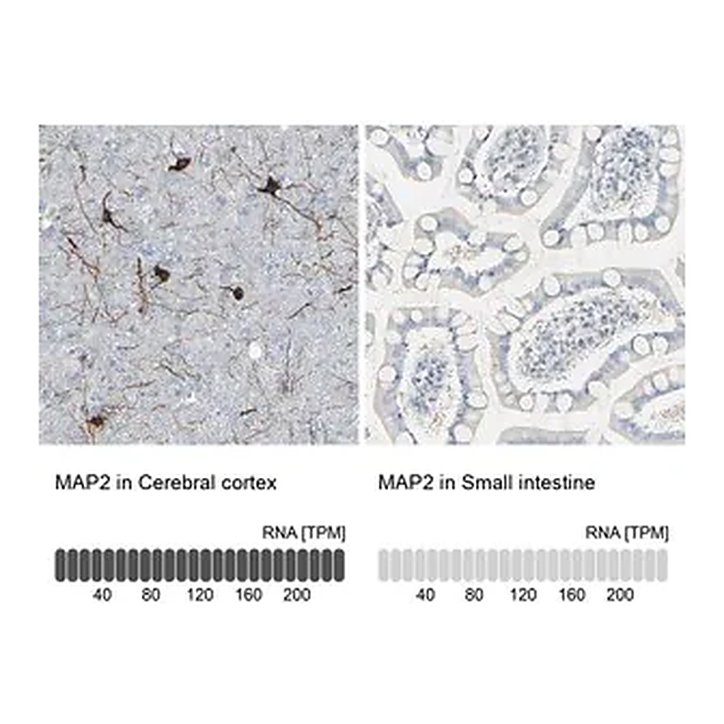 Merck Anti-MAP2 antibody produced in rabbit