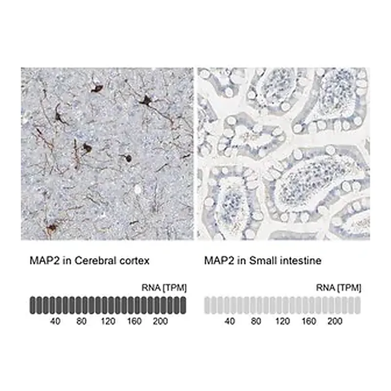 Merck Anti-MAP2 antibody produced in rabbit