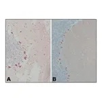 Merck Anti-Calbindin-D-28K (EG-20) antibody produced in rabbit