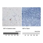 Merck Anti-SST antibody produced in rabbit