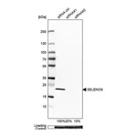 Merck Anti-SELENOS antibody produced in rabbit