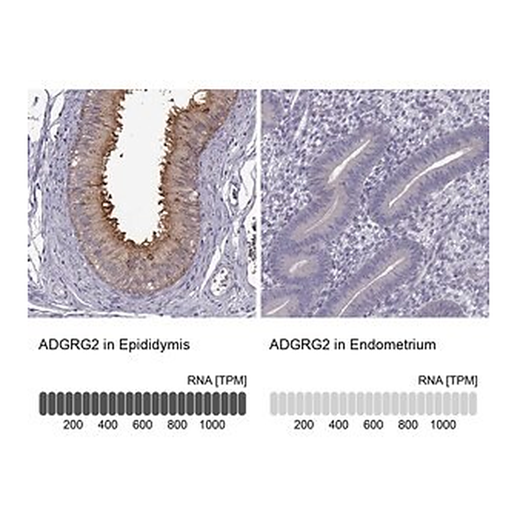 Merck Anti-ADGRG2 antibody produced in rabbit
