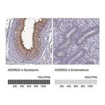 Merck Anti-ADGRG2 antibody produced in rabbit