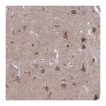 Merck Anti-LMTK3