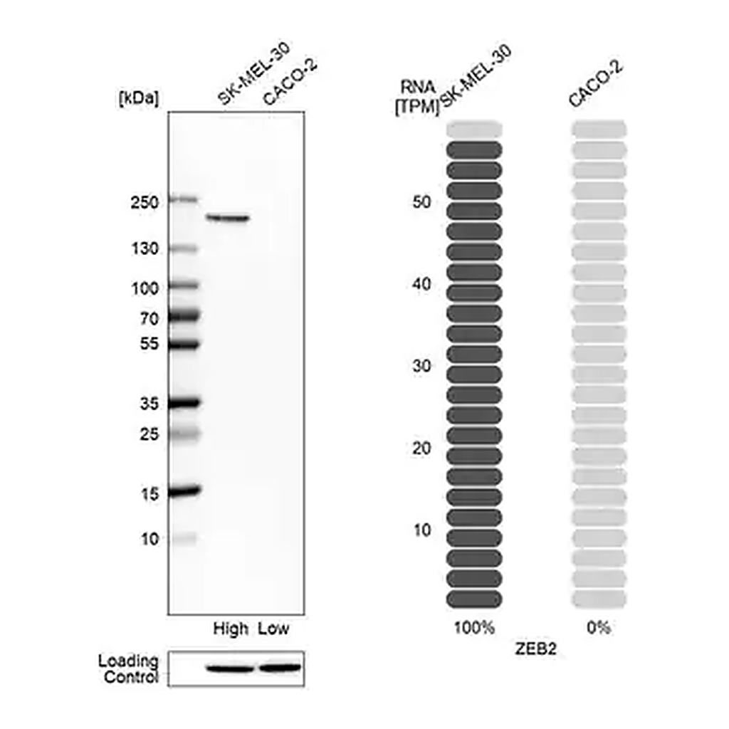 Merck Anti-ZEB2 antibody produced in rabbit