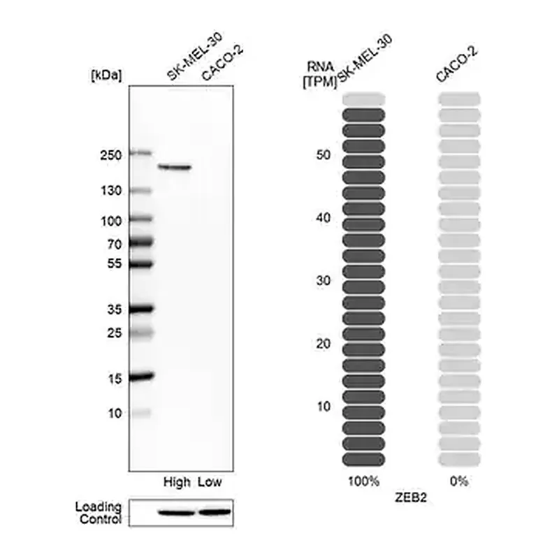 Merck Anti-ZEB2 antibody produced in rabbit