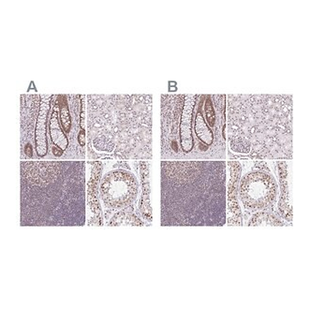Merck Anti-PTPN2 antibody produced in rabbit