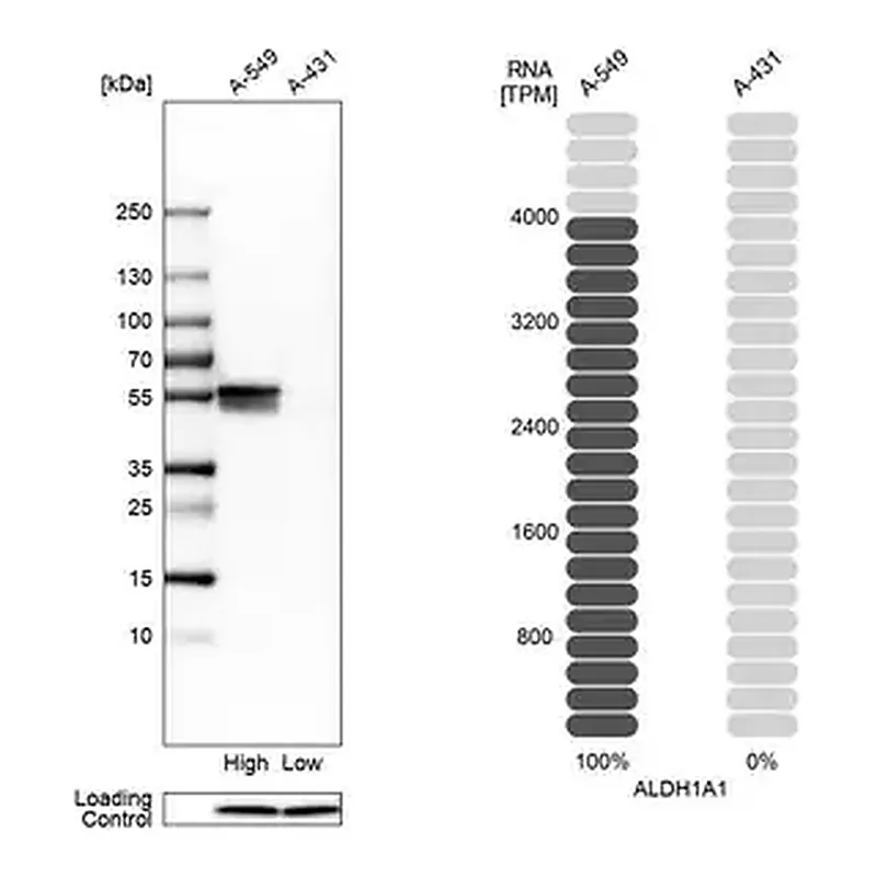 Merck Anti-ALDH1A1 antibody produced in rabbit