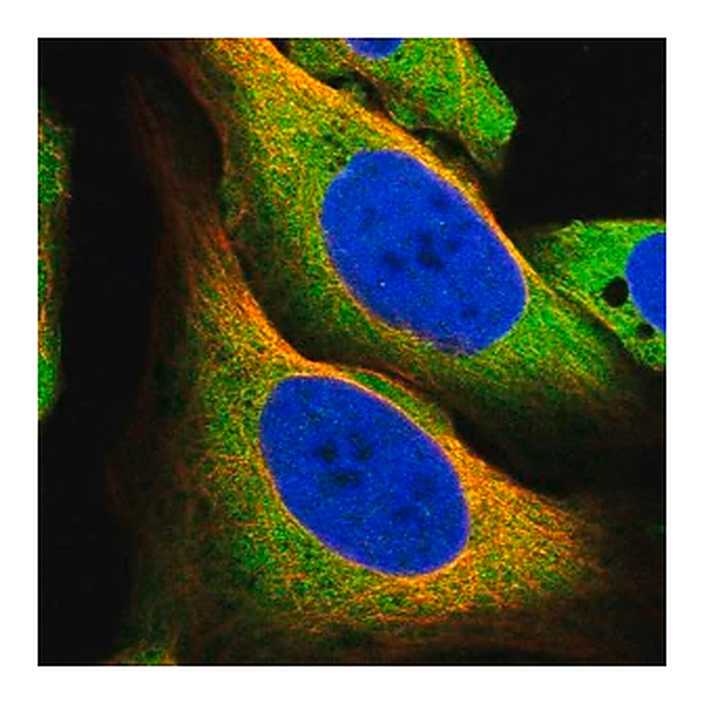Merck Anti-MCOLN1 antibody produced in rabbit