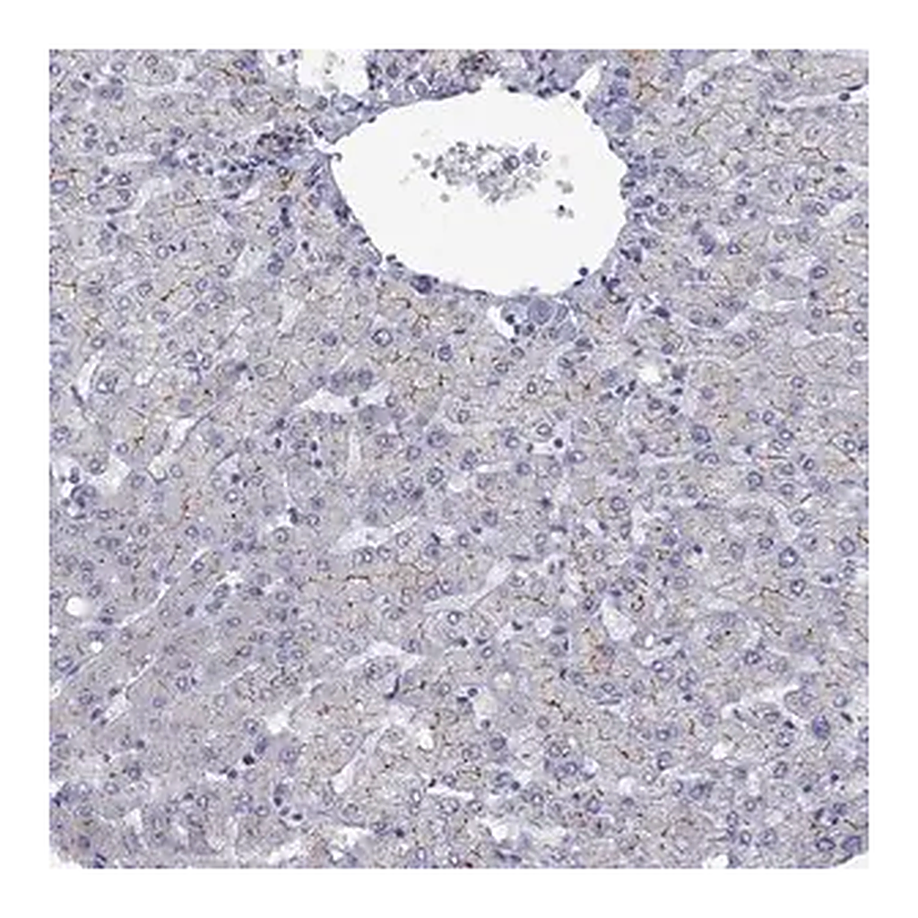 Merck Anti-ABCB4 antibody produced in rabbit