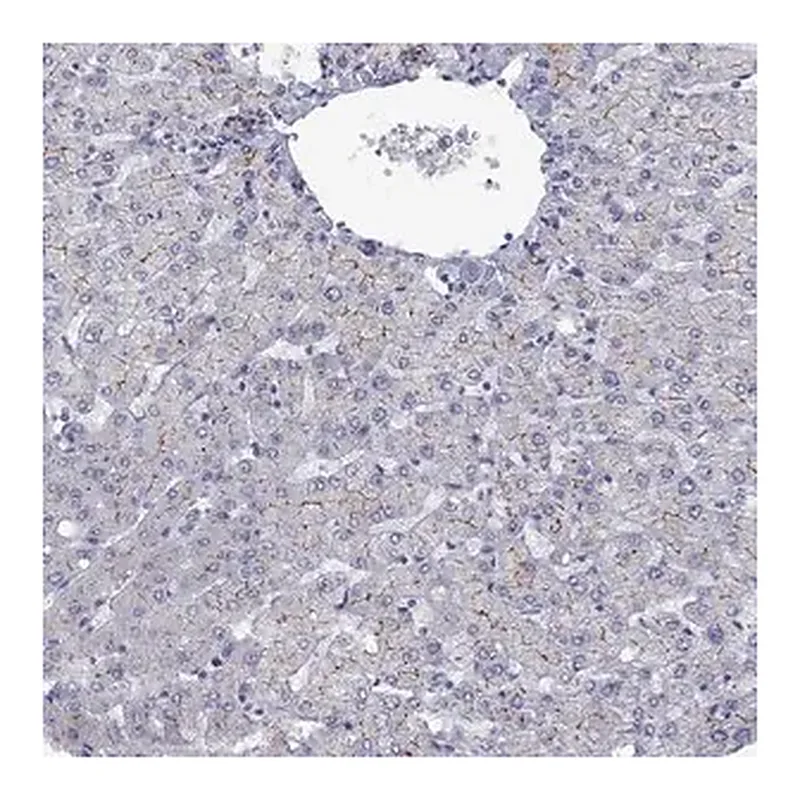 Merck Anti-ABCB4 antibody produced in rabbit