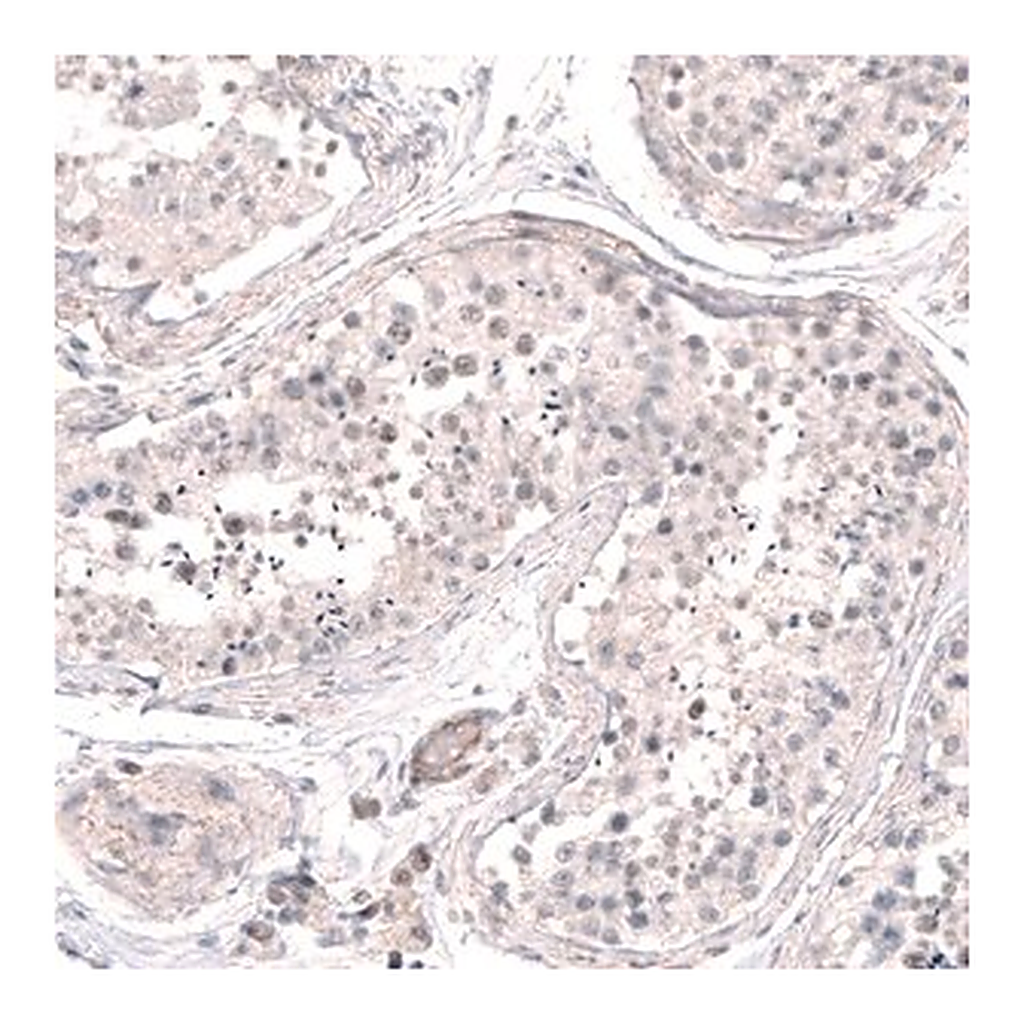 Merck Anti-SMC6 antibody produced in rabbit