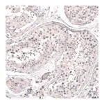 Merck Anti-SMC6 antibody produced in rabbit