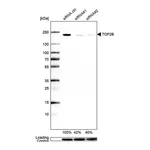 Merck Anti-TOP2B antibody produced in rabbit