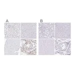 Merck Anti-CXorf67 antibody produced in rabbit
