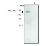 Merck Anti-ATP13A2 (C-terminal region) antibody produced in rabbit