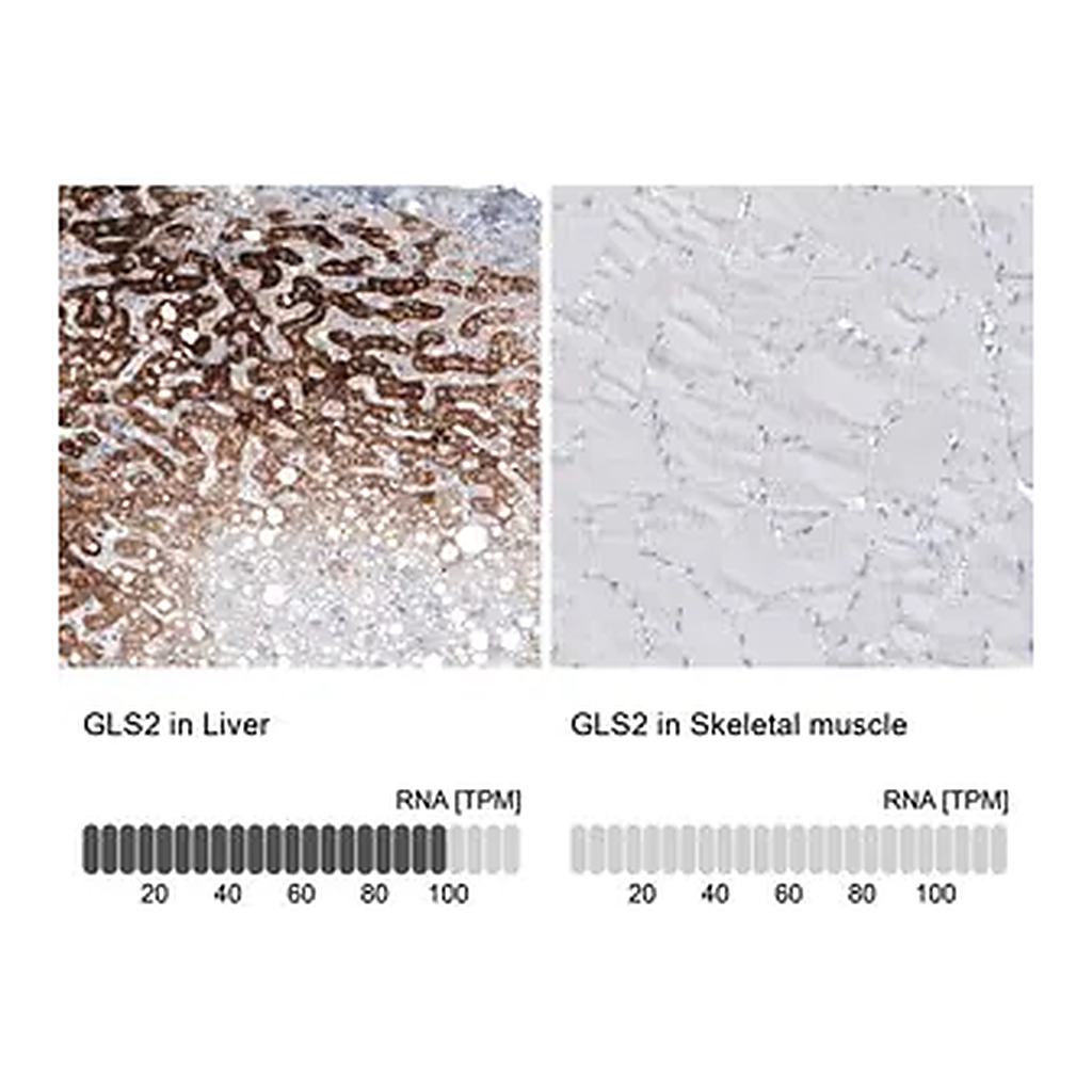 Merck Monoclonal Anti-GLS2 antibody produced in mouse
