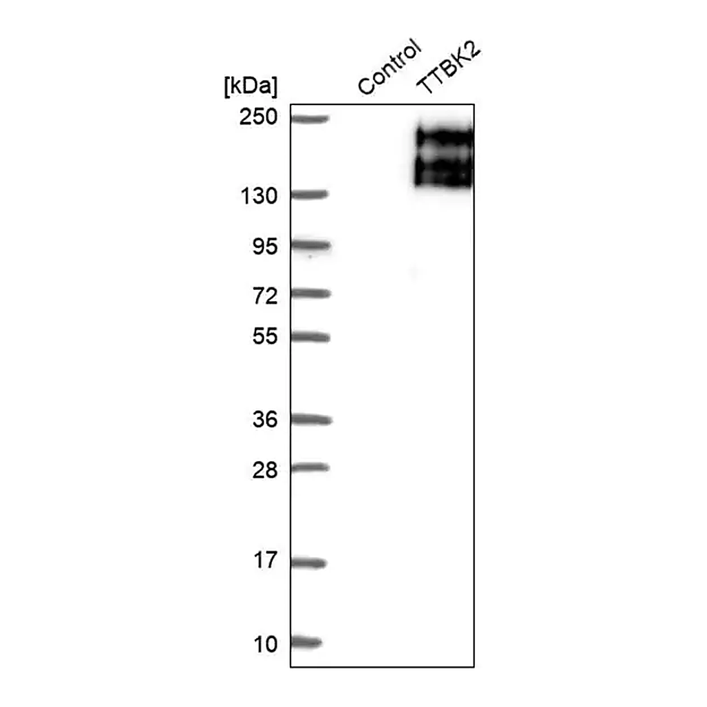 Merck Anti-TTBK2 antibody produced in rabbit