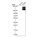 Merck Anti-TTBK2 antibody produced in rabbit