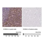 Merck Anti-S100A4 antibody produced in rabbit