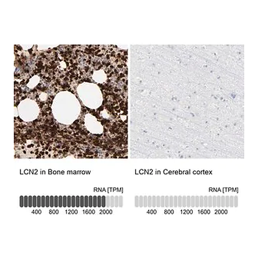 Merck Anti-LCN2 antibody produced in rabbit