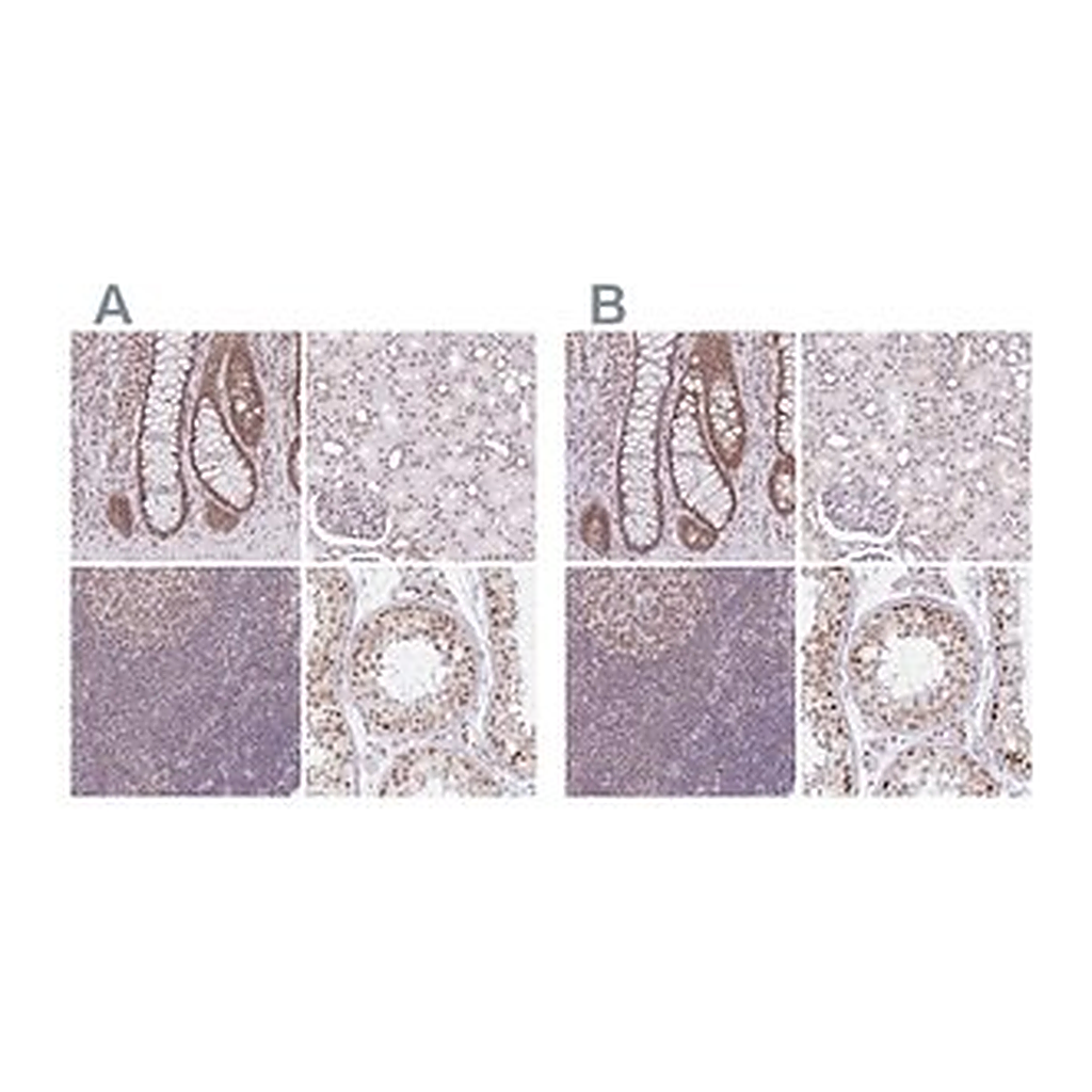 Merck Anti-PTPN2 antibody produced in rabbit