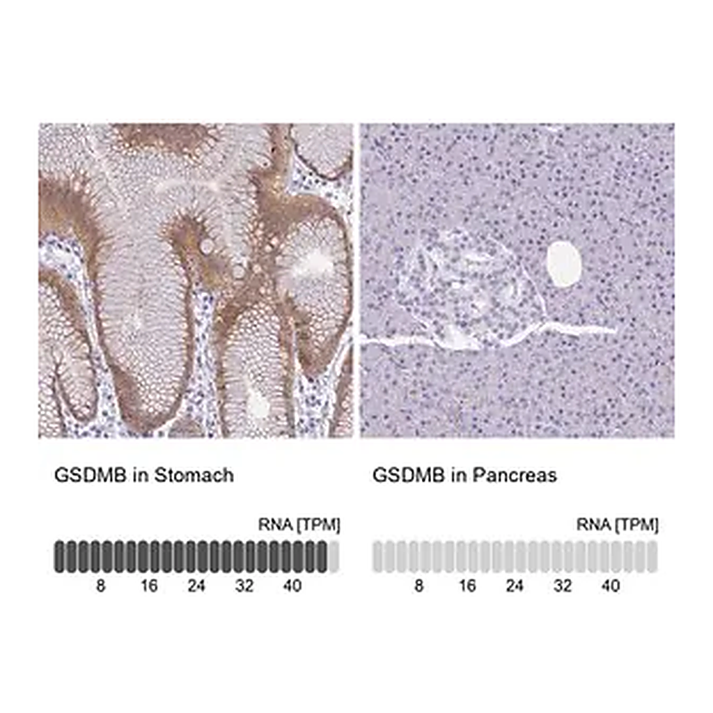 Merck Anti-GSDMB antibody produced in rabbit