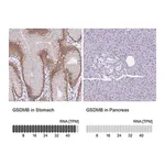 Merck Anti-GSDMB antibody produced in rabbit