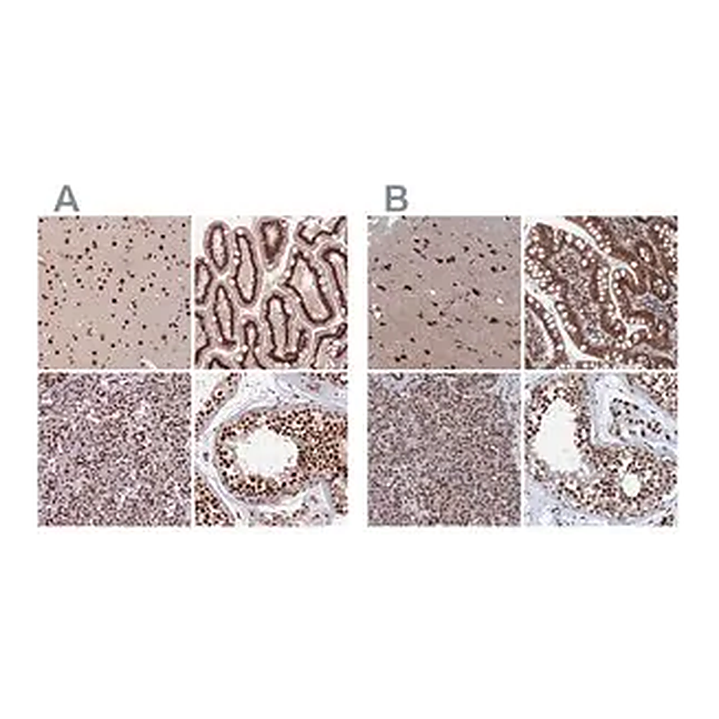 Merck Anti-CTB-50L17.10 antibody produced in rabbit