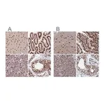 Merck Anti-CTB-50L17.10 antibody produced in rabbit