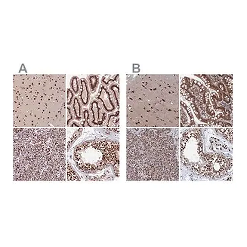 Merck Anti-CTB-50L17.10 antibody produced in rabbit