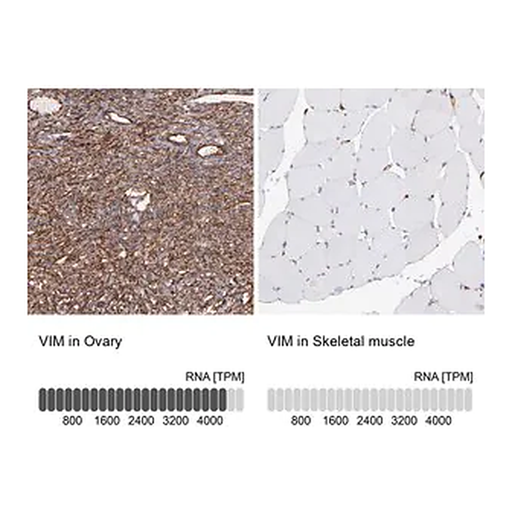 Merck Anti-VIM antibody produced in rabbit