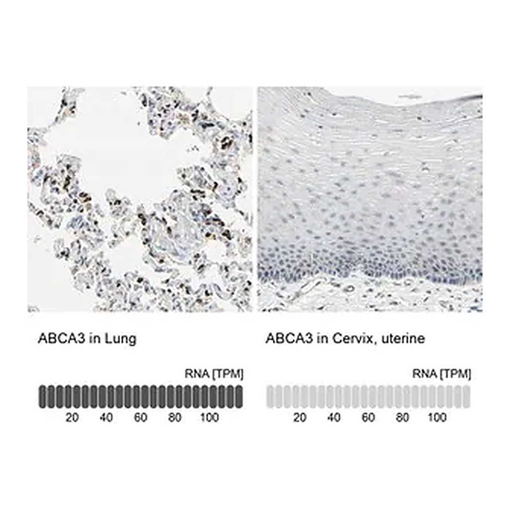 Merck Anti-ABCA3 antibody produced in rabbit