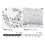 Merck Anti-ABCA3 antibody produced in rabbit
