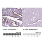 Merck Anti-HTR2B antibody produced in rabbit