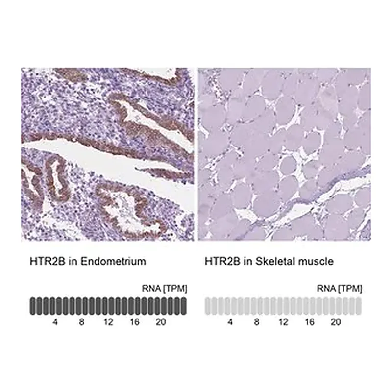 Merck Anti-HTR2B antibody produced in rabbit